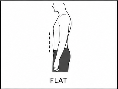 Flat